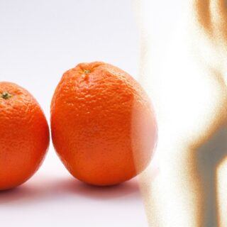Cellulite Cellulite – Ursachen, Symptome und Behandlung