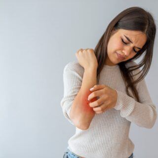 Schuppenflechte Schuppenflechte – Ursachen, Symptome und Behandlung