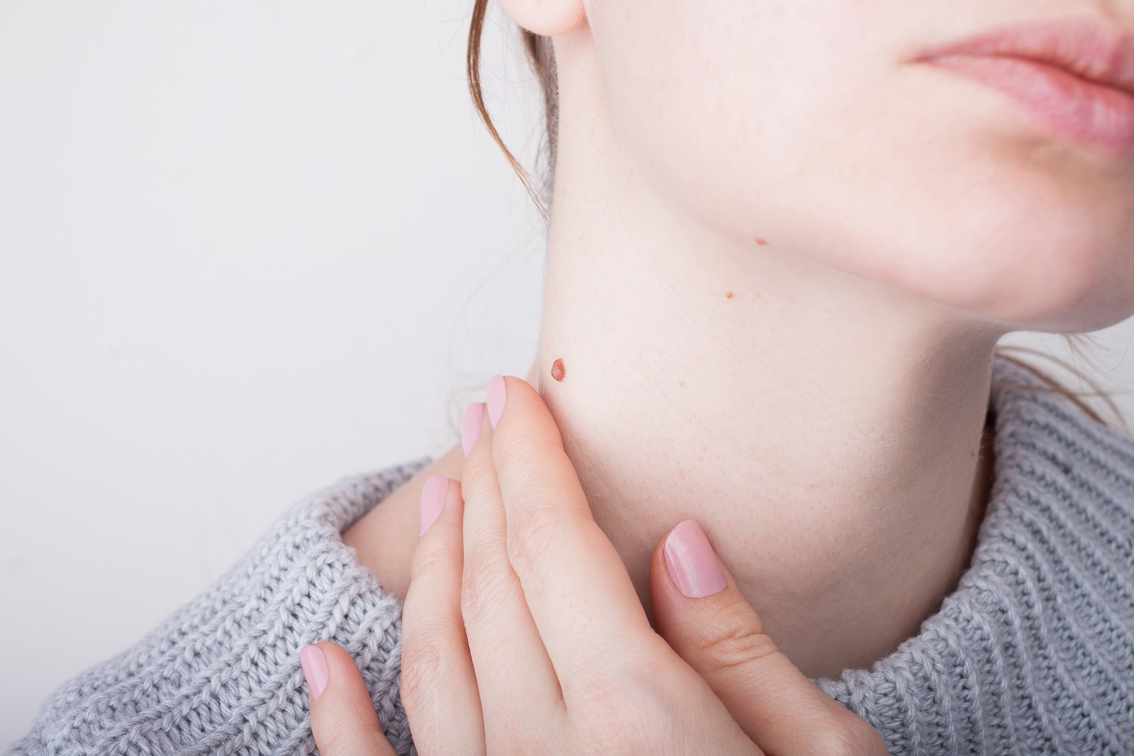 Warzen – Ursachen, Symptome und Behandlung