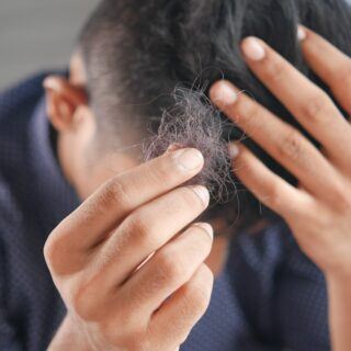 Selbsttest – Haarausfall bei Männern Selbsttest – Haarausfall bei Männern