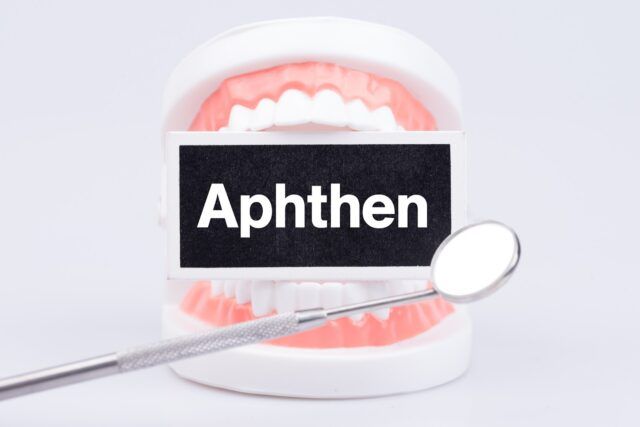 Aphthen – Ursachen, Symptome und Behandlung