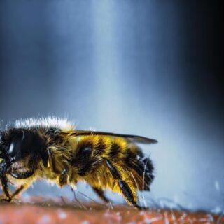 Insektengiftallergie Insektengiftallergie – Ursachen, Symptome und Behandlung